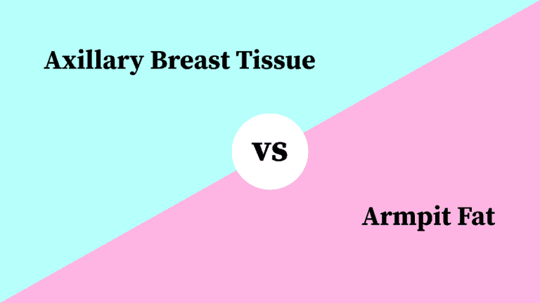 Differences Between Axillary Breast Tissue and Armpit Fat