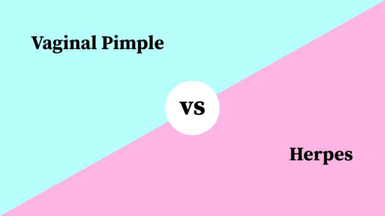 Differences Between Vaginal Pimple and Herpes