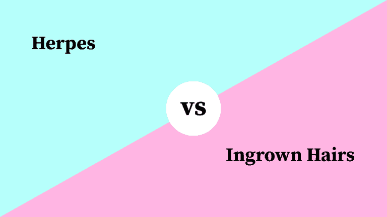 Differences Between Herpes and Ingrown Hairs